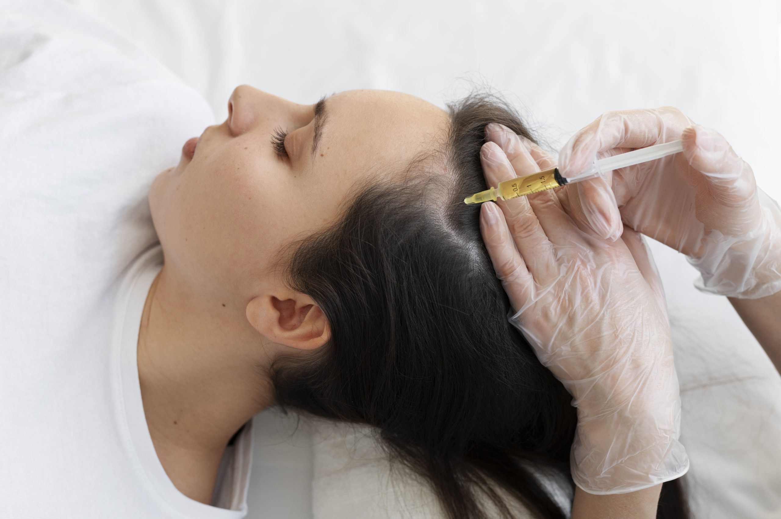 Woman receiving a scalp PRP treatment